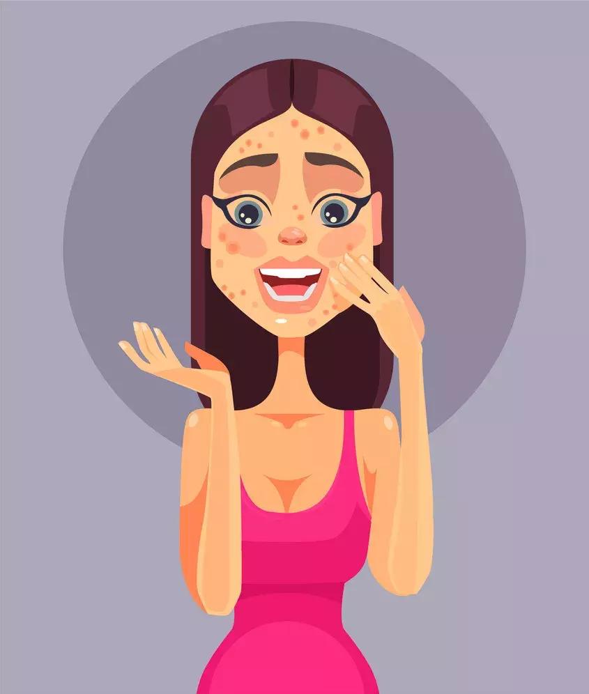 金银花对付痘痘,对付所有痘痘的药膏