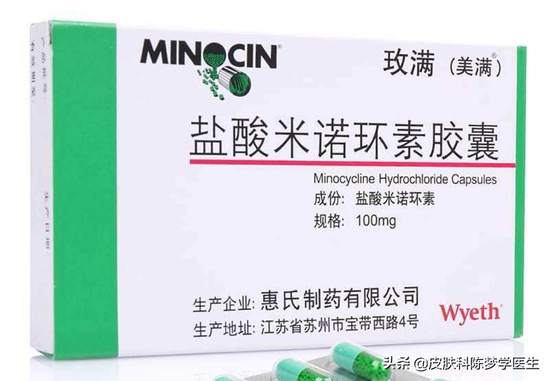 青春痘首选治疗方案是什么？答案都在这里了