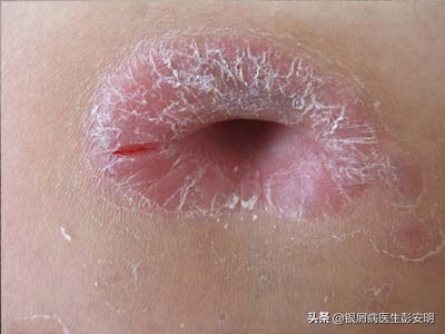 6岁女孩抠肚脐,六岁女童抠肚脐