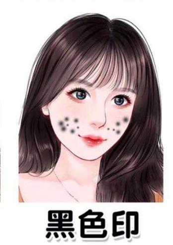 快速淡化痘印又简单的方法,怎样有效祛除痘印痘坑物理方法