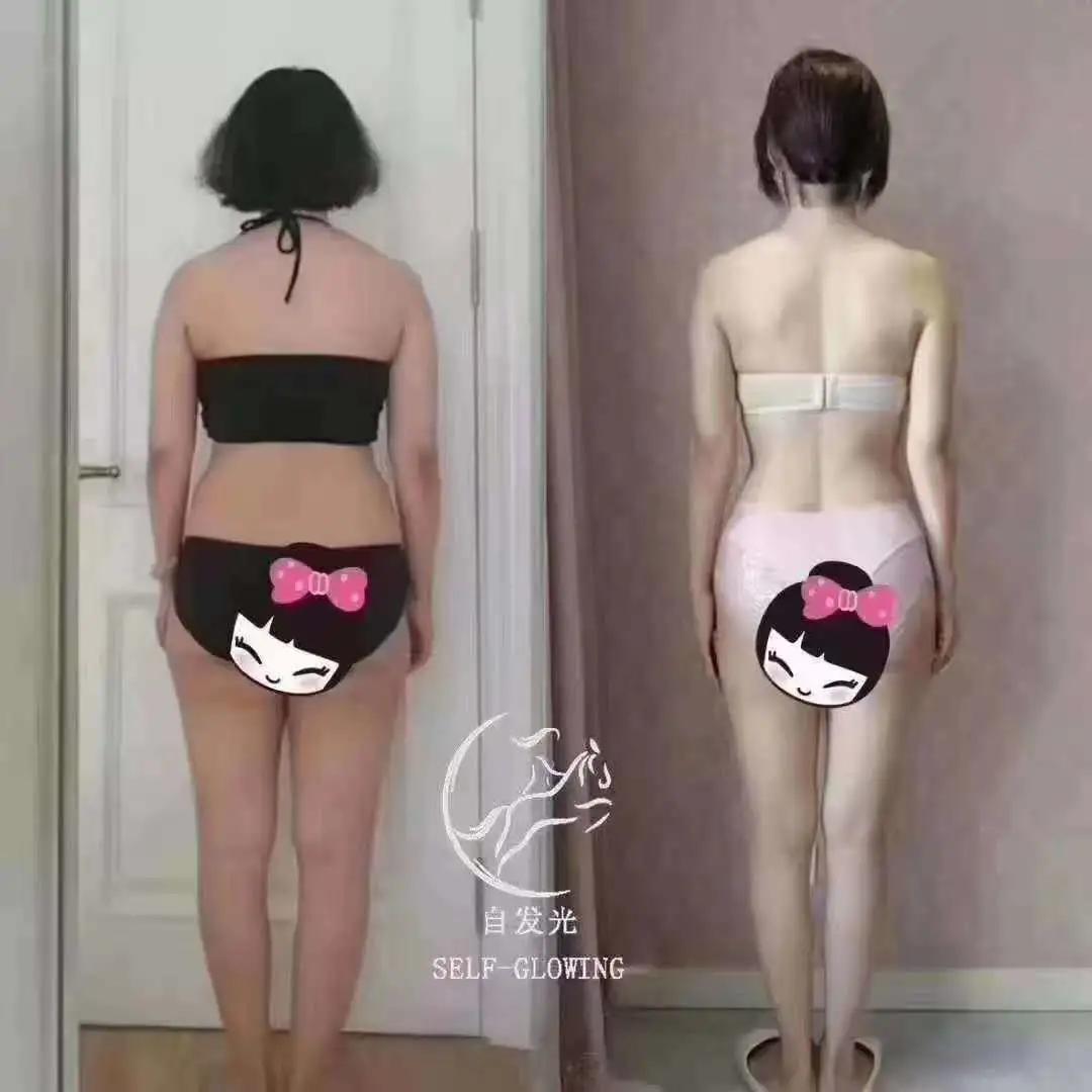 抗衰老预防垮脸,抗皱抗衰去细纹有哪些