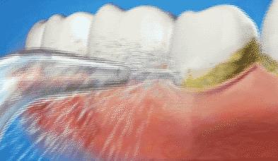 一张嘴臭牙齿就臭怎么办,一张嘴就口臭小妙招