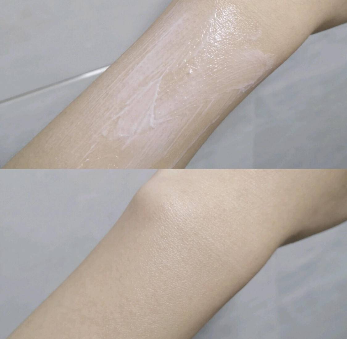 关节去黑小妙招,怎么预防关节变黑