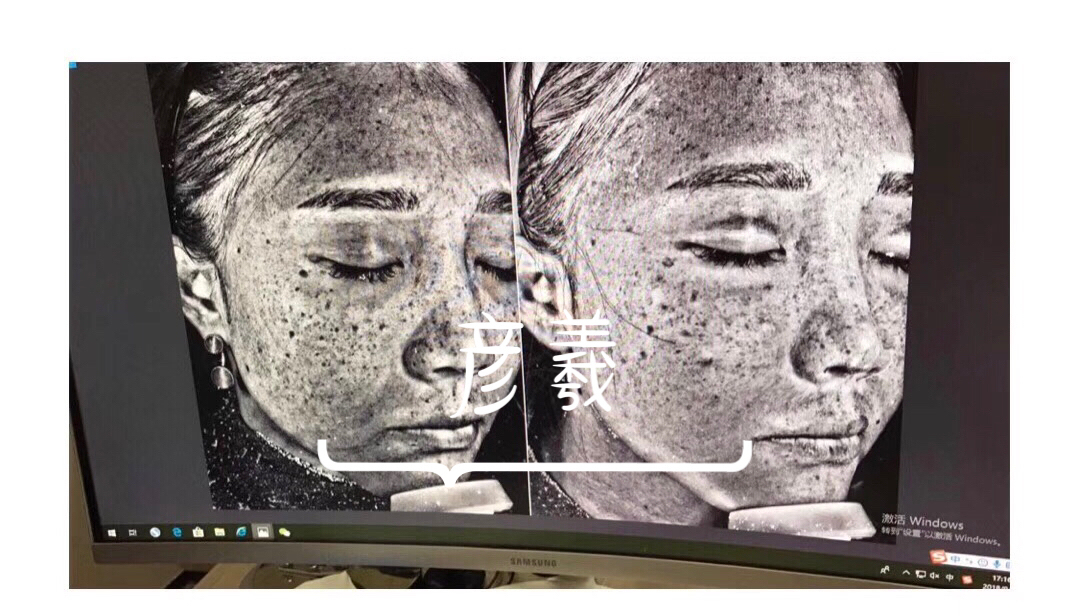 国内医美和泰国医美有什么区别,国内医美针剂为什么这么贵