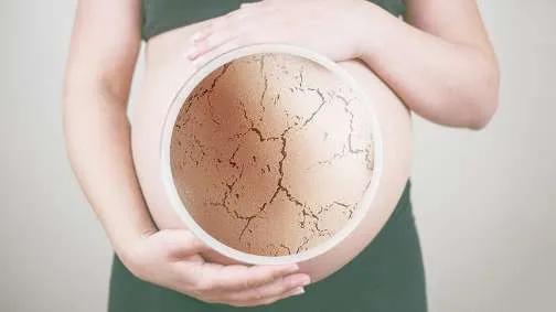 防妊娠纹霜什么时候用效果最好,防妊娠纹霜十大排名