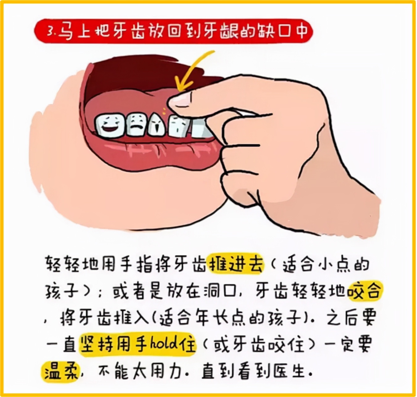 牙齿断了把牙根拔出,牙齿断了拿另一半能补吗