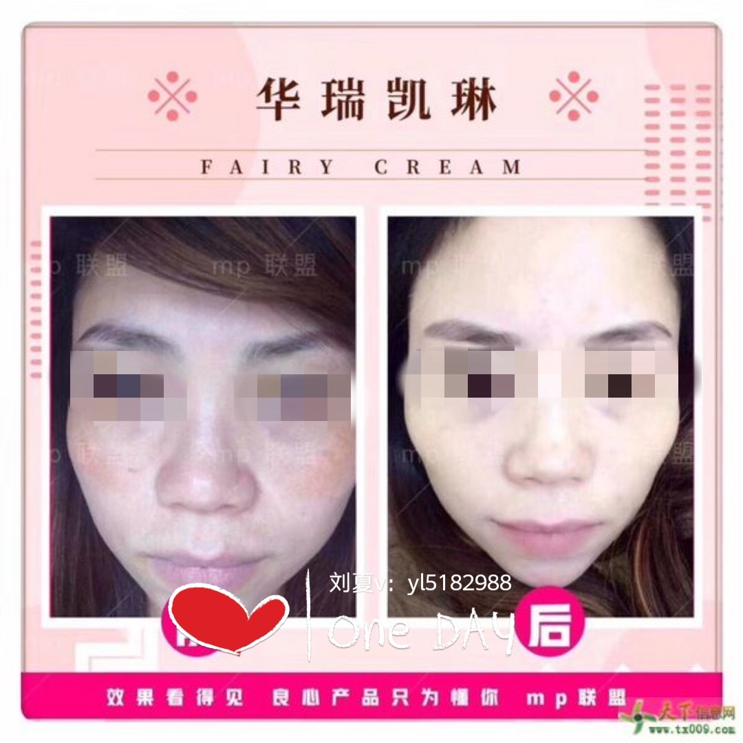 祛斑美肤最有效的滋养霜