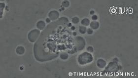 同样的癌症，一个活了一年，一个活了三十年，什么原因？