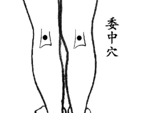 中医治疗心梗10秒自救方法,收好老祖宗的7把救命钥匙