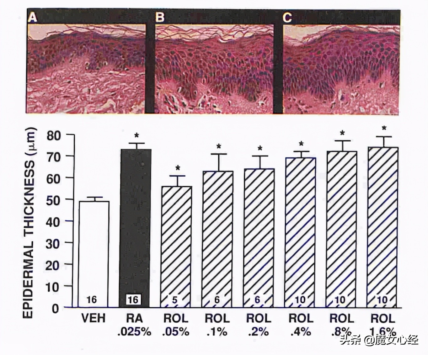 这样使用A醇产品，既能抗皱淡纹，又不伤害皮肤