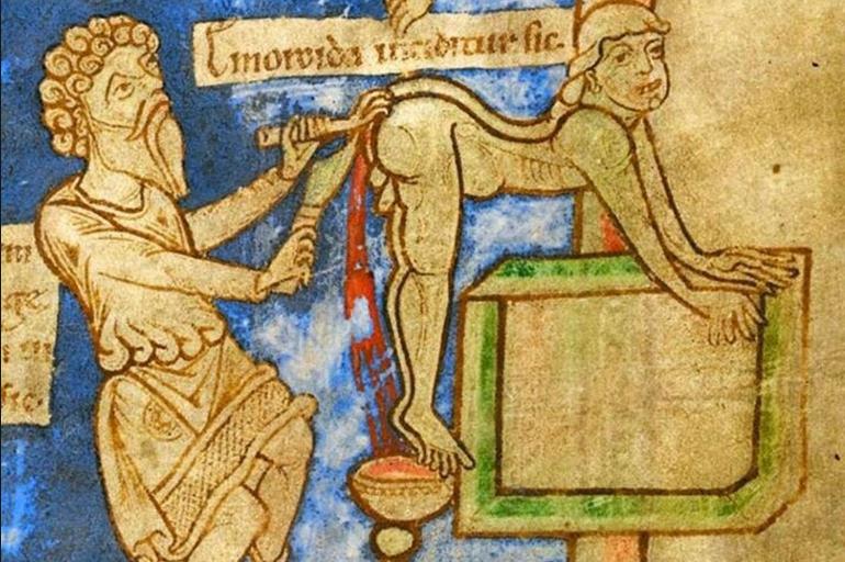 会玩的西方人,硬生生将它从治疗痔疮的工具,玩成性癖玩物