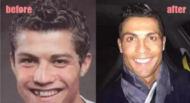 颜值不够美颜来凑系列,颜值不够医美来凑