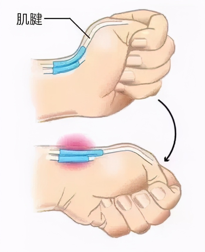 生孩子直接衰老11岁?产后衰老主要体现在哪些方面?如何应对?