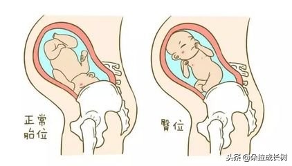 怀孕几周检查胎位正不正,怀孕几周胎位才会固定