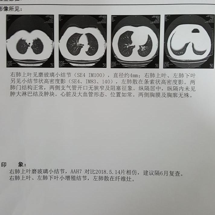 结节息肉囊肿增生哪个更容易癌变,结节囊肿增生息肉有什么区别