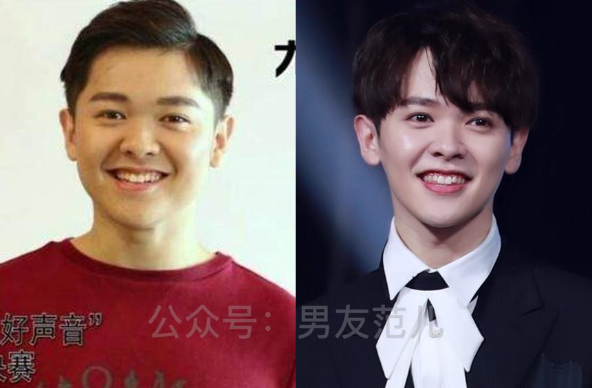 娃娃脸不好看怎么办,娃娃脸不够圆怎么办