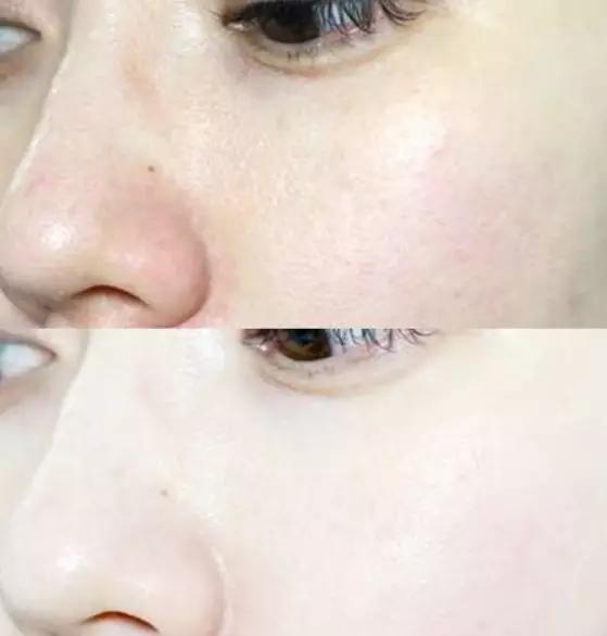 30多岁的她变瘦皮肤松弛,37岁女人瘦下来后变老了