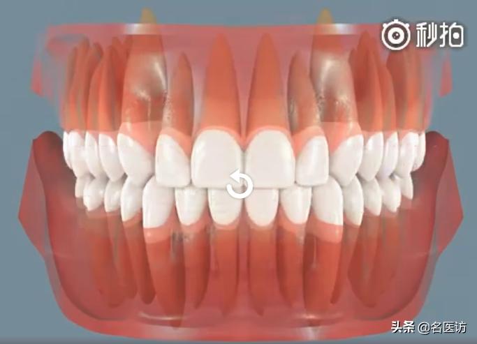 牙齿矫正保持器注意事项,衡阳牙齿矫正后注意什么