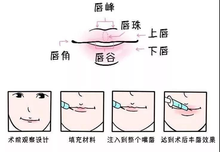世界上最厚的嘴唇,世界上嘴唇最厚的人是谁