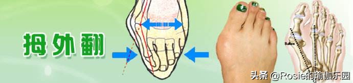 穿高跟鞋踝关节疼,膝盖痛脚酸怎么办