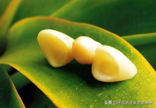 全明星都在做的烤瓷牙真的好吗,为什么明星全瓷牙要几百万