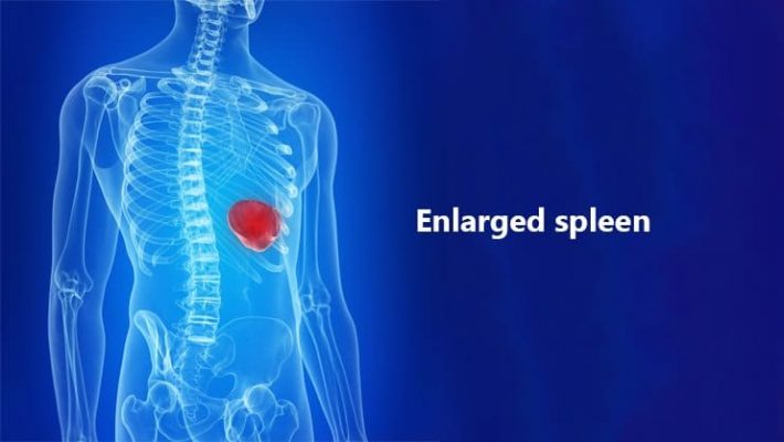 体检说脾增大什么意思,体检报告说肝硬化可能性比较大