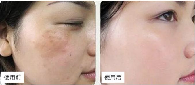 国外比国内火的护肤品,国外卖得比中国便宜的国产品牌