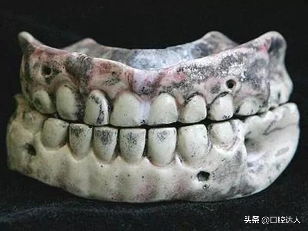 最全的牙科历史发展,牙医们大喊惊讶
