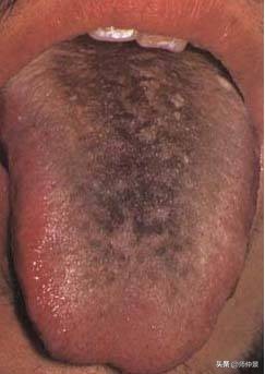 最实用的舌诊图六大舌象,舌诊深入学习书