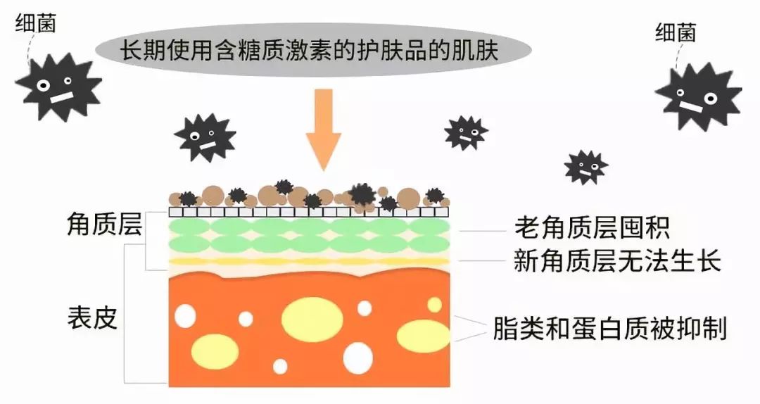 角质层薄脸上有红血丝怎么调理,角质层薄有红血丝脸发红怎么修复