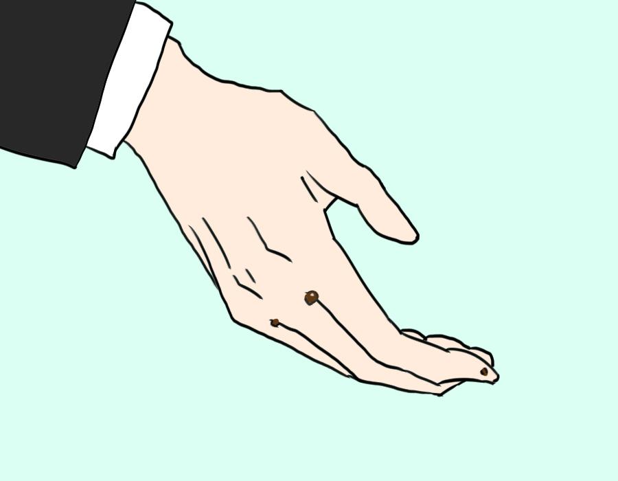 医声-有医招⑪|指甲突然变黑了?你可能得了这种病