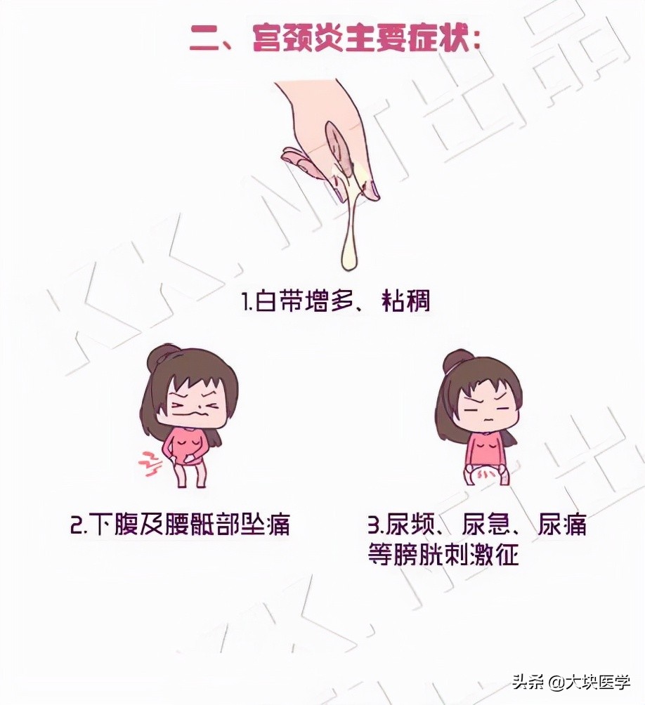 女性腰疼是妇科病的哪一种,女性妇科病腰疼