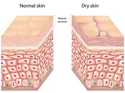 脸上干纹细纹多怎么办,怎样改善脸上的干纹和细纹