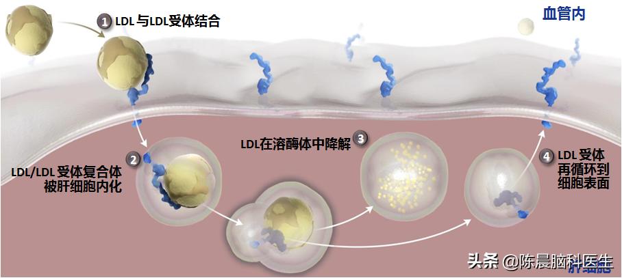 动脉粥样硬化斑块能够药物消除吗,抗动脉粥样硬化的降压药物
