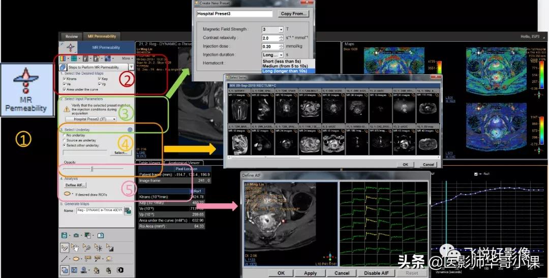 「飞利浦磁共振技术」DCE技术原理及应用（二）