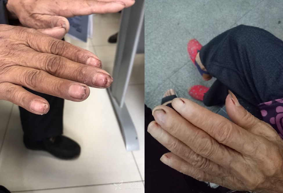 老人家用超大的剪刀剪指甲,老人剪指甲更轻松