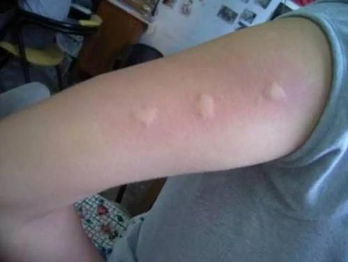 端午节怎么避毒,端午节需要注意的事项