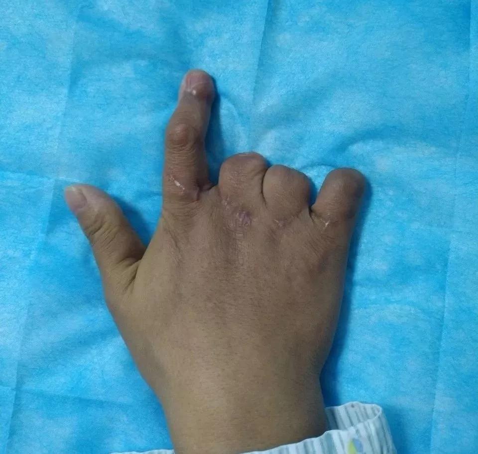 杨晓荣：酷爱钻研专挑“硬骨头”啃的学科带头人