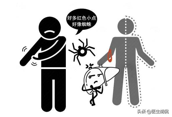 哪些疾病会导致肩膀上有白色条纹,肩膀出现3种情况或是癌症警告