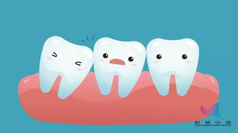 明星拔了智齿有垮脸的吗,明星拔完智齿