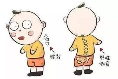 孩子驼背怎么一招解决,孩子有点驼背应该怎么办