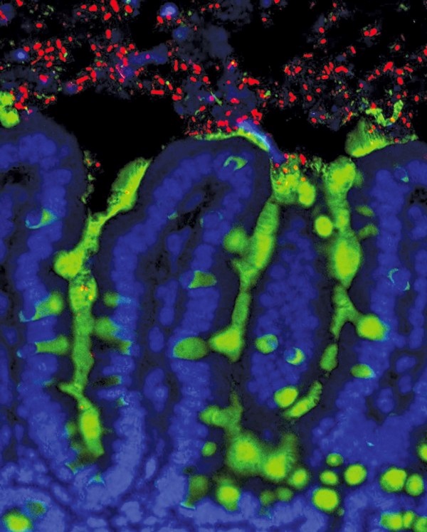 NatureOutlook：微生物，食物过敏的抵御者？