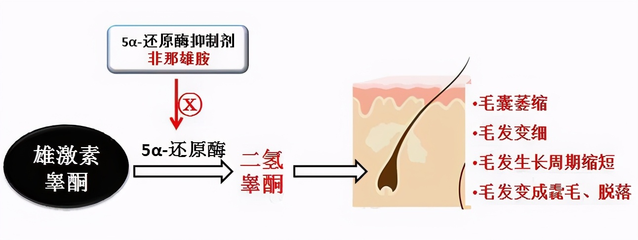 23岁脱发严重发量少怎么办 (脱发严重头发脆容易断是什么原因)