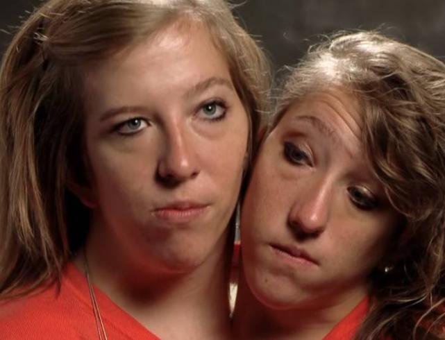 双头龟是基因突变吗,日本人类基因突变