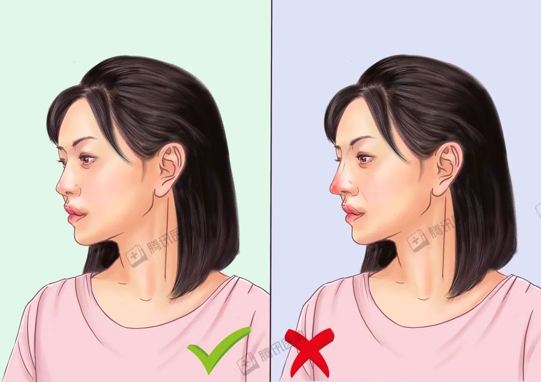 隆鼻的几大风险,隆鼻真的10个做9个后悔吗