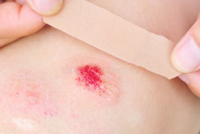 村里人说这个痣非“凶”即“淫”,吓得妈妈赶紧带孩子去点痣