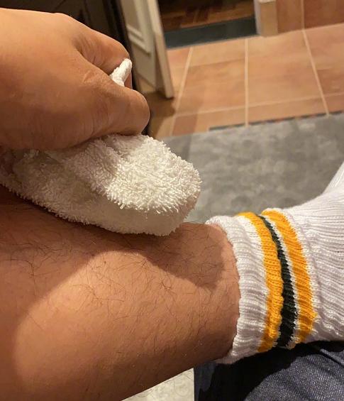 张亮腿受伤肿起大包,晒照却被网友骂活该,本人这样回应显情商