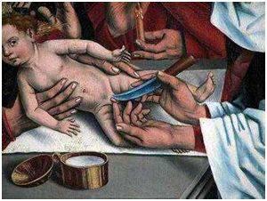 关于包皮包茎疾病的介绍,包茎通俗易懂的解释