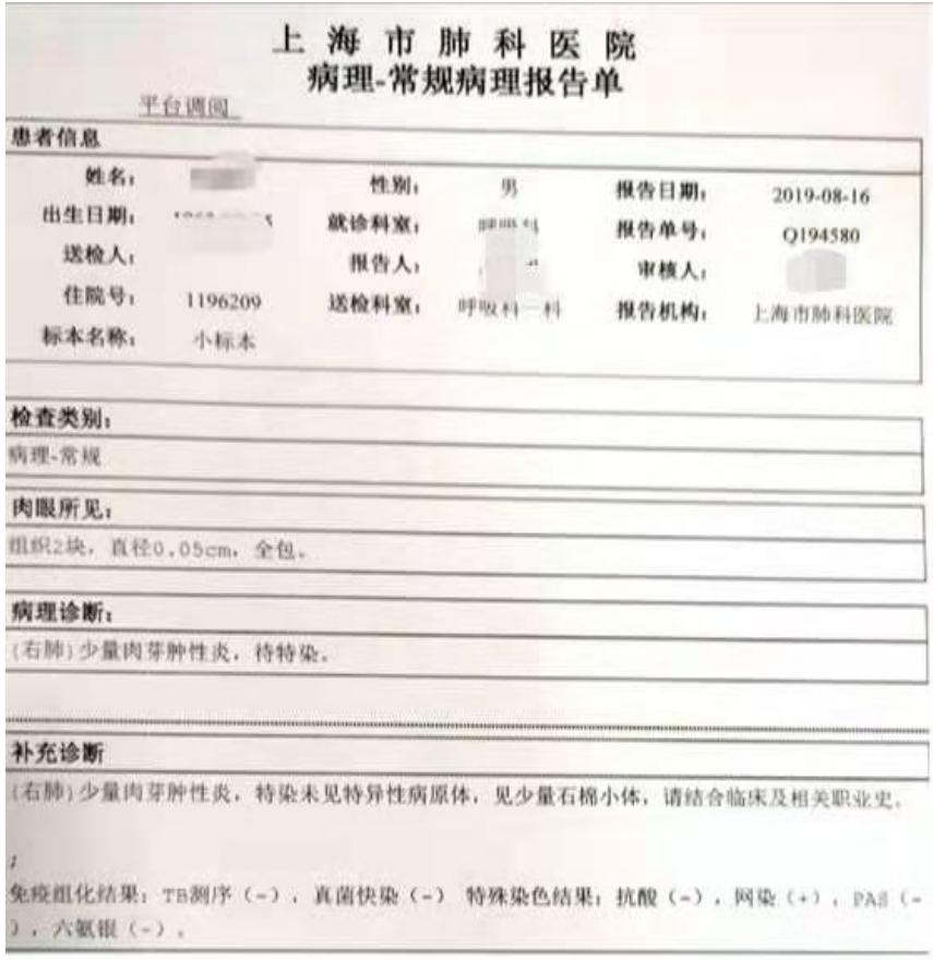 56岁男性发现双肺,56岁男性发现双肺数百个结节