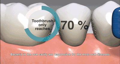 天天宅家胡吃海塞,水牙线比电动牙刷更靠谱!用过的都知道